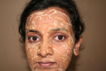 Marigold Face Pack...