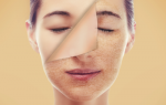 Truth your skin woul...