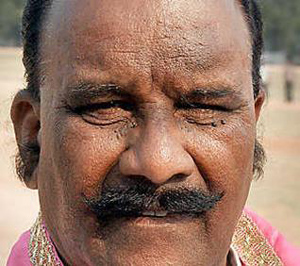 telangana state home minister yayini narasimha reddy ill health joined in yeshoda hospital