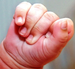 graveyard girl child siddipet medak district