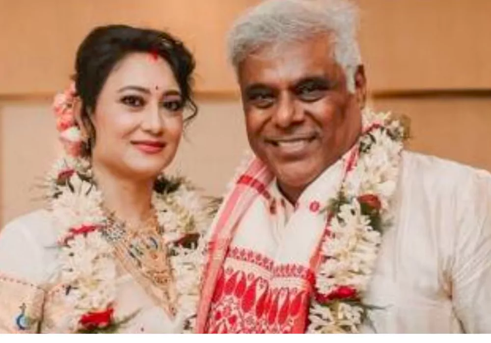 Ashish Vidyarthi injured in road accident