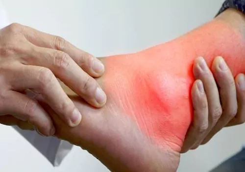Ayurvedic tips to uric acid
