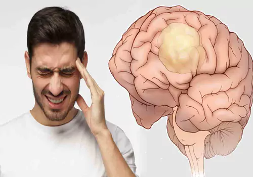 Brain Tumor problems