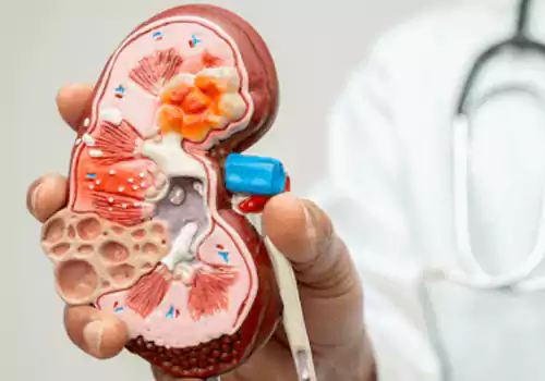 Creatine Effects on Kidneys