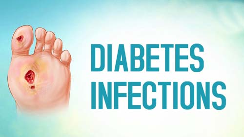 Diabetes Infections