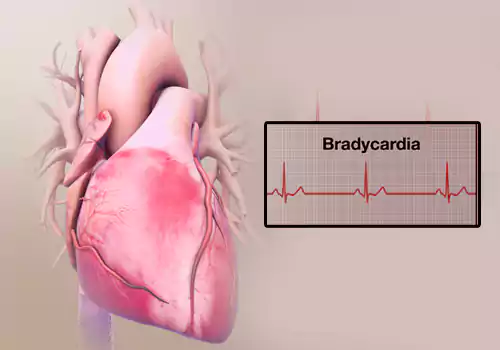 Do you know about Bradycardia disease