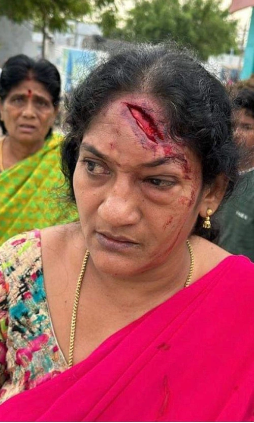 ycp polling attacks on woman