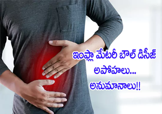 Medical myths about ibd
