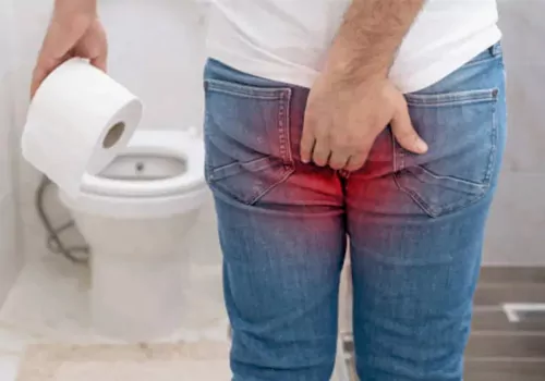 Home Remedies for Piles