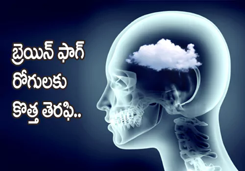 Brain Fog new treatment after corona