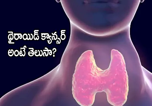 Thyroid cancer Symptoms