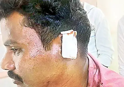YCP in Frustration
