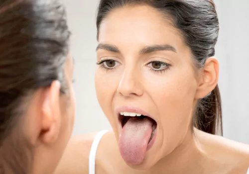What your tongue says about your health