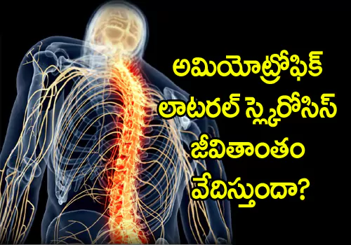 Amyotrophic lateral sclerosis affects your nervous system