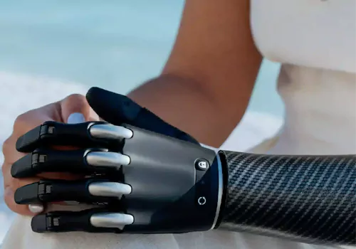 ఏఐ టెక్నాలజీతో చేయి.. దివ్యాంగులలో ఆత్మవిశ్వాసాన్ని నింపే బయోనిక్ హ్యాండ్! 