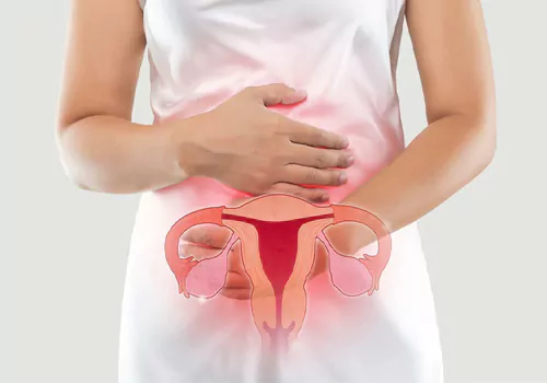 What is ovarian cancer