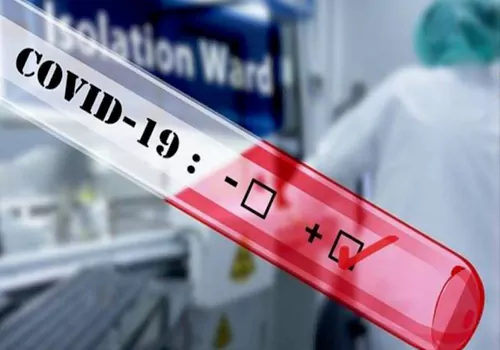 covid antibodies key study on antibodies body