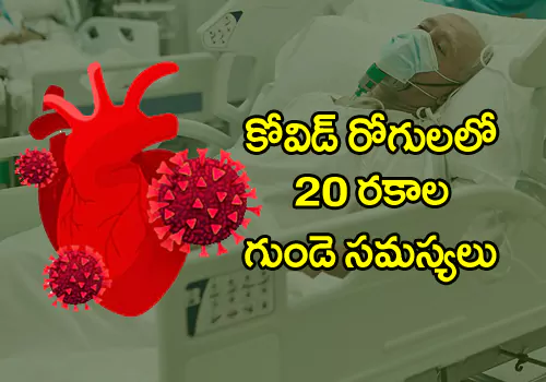 COVID Patients at Risk for 20 Cardiovascular Diseases