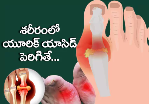 effects of uric acid in body