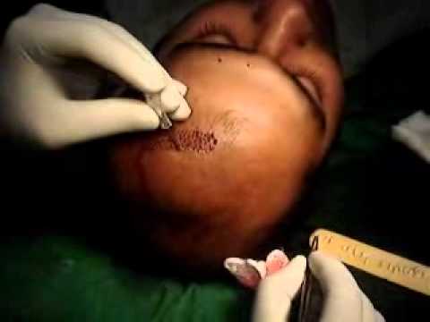 madras medical college