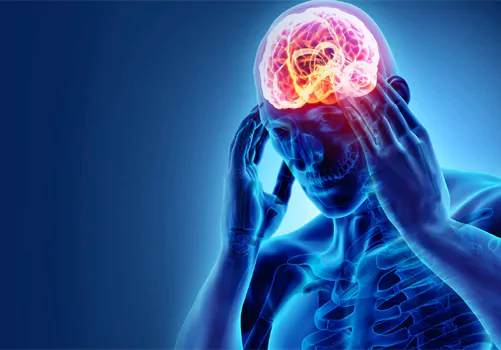 difference between f and migraine