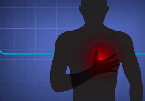 Cardiac Arrest Heart Attack