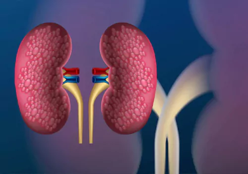 Treatment For Kidney Cancer