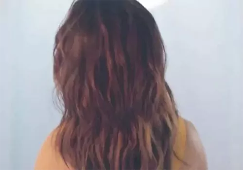 prev-img