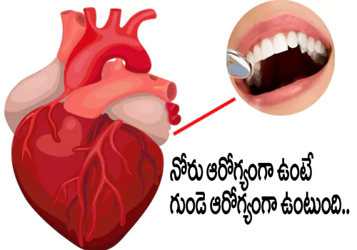 oral in health lead to heart problems