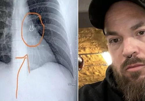 nose ring in lungs!