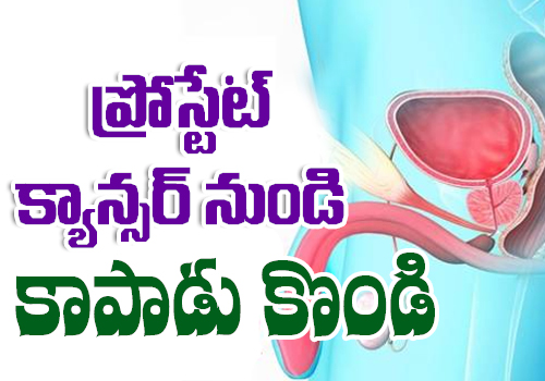 prostate cancer symptoms