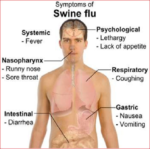 Swine Flu