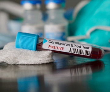 Journalist tests positive for coronavirus