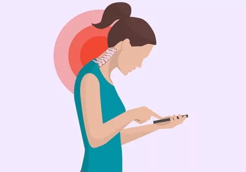 text neck syndrome symptoms