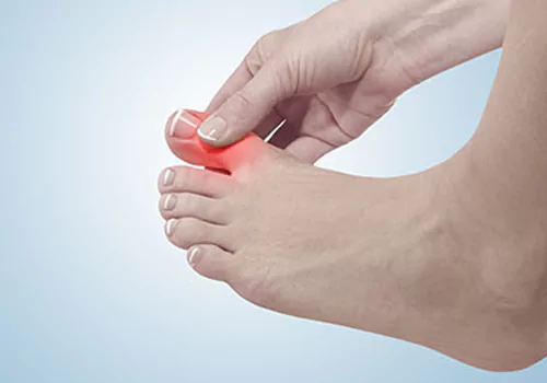 do you know These foods increase uric acid