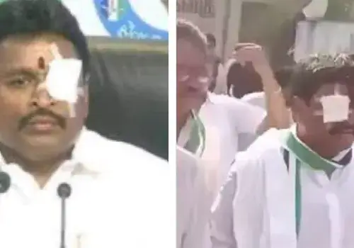 vellampqalli bandage shifted from left to right