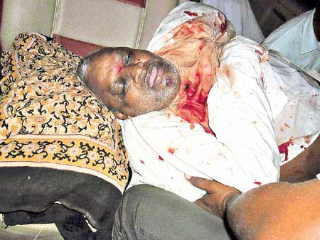 Yerram Naidu dead body, Yerram Naidu dead body photos, Yerram Naidu dead body pics, Yerram Naidu dead body pictures, Yerram Naidu dead body images, Yerram Naidu dead body  