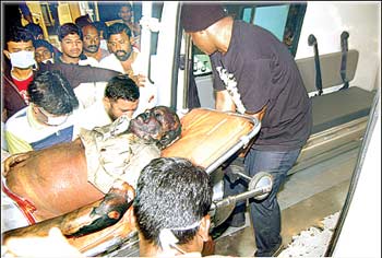 Fire accident at shooting