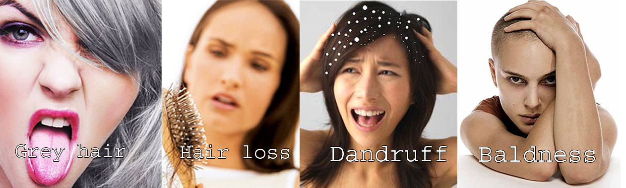 Hairy tales, Hair care, dandruff, baldness, tips for hair care,hair loss, Grey hair, split hair.