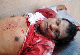  patolla govardhan reddy murder