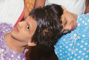 Siamese twins Veena and Vani 